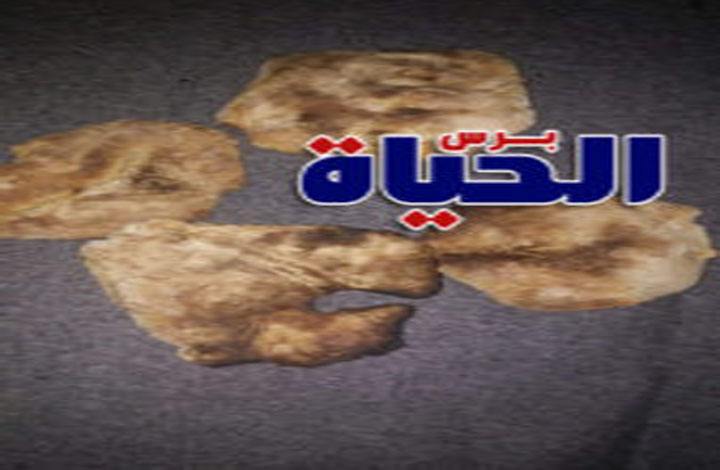 Dss 1