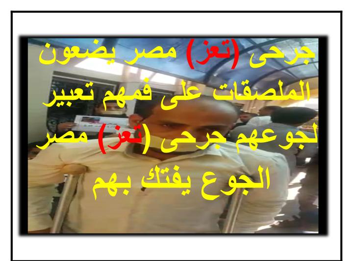 جرحى تعز في مصر يناشدون الحكومة اليمنية صرف مستحقاتهم واستكمال علاجهم Bea35c95 63dc 45e2 970f 4b6c5d98fec0