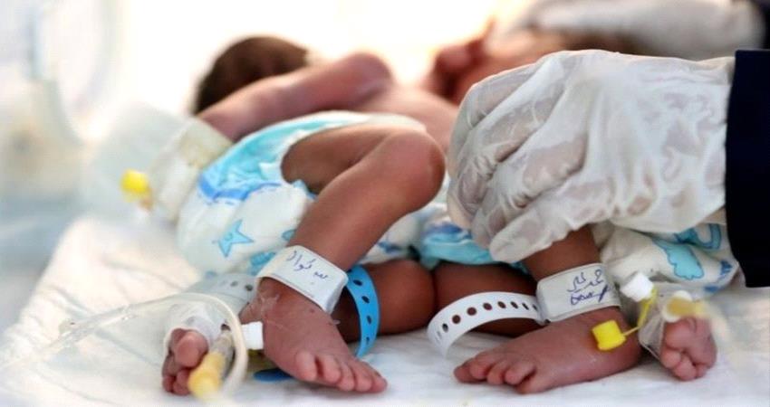 نداء لإنقاذ توأمين ملتصقين "في حالة حرجة" بصنعاء 19 12 20 848861863