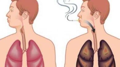 صورة كيفية تنظيف الرئتين من آثار التدخين في 3 أيام فقط