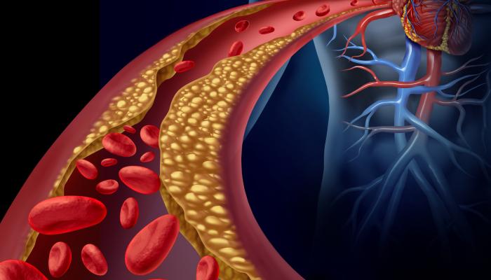 133 195442 Tips Reduce High Cholesterol 700x400