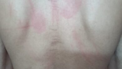 صورة مسلحون مجهولون يختطفون ناشطا بمدينة عدن ويعذبونه حتى الموت